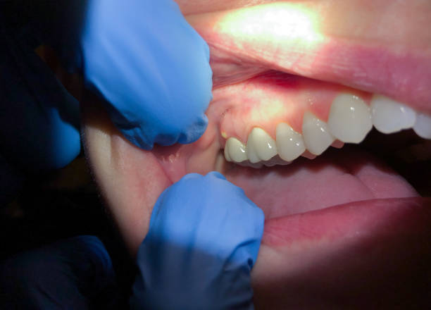 Best Cosmetic Emergency Dentistry in Ardmore, OK