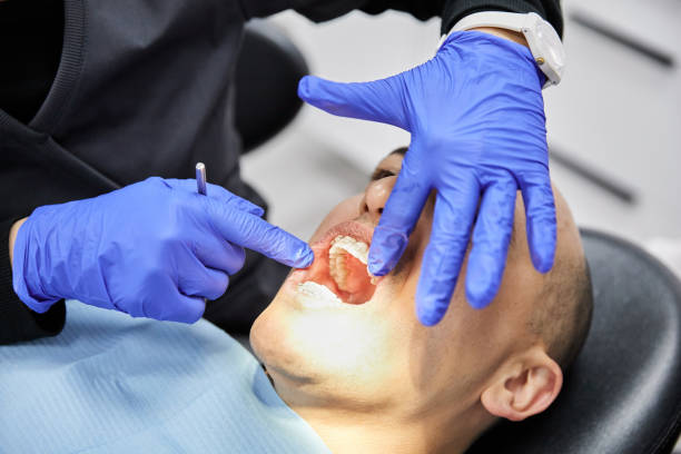 Best Emergency Dental Care for Broken or Chipped Teeth in Ardmore, OK